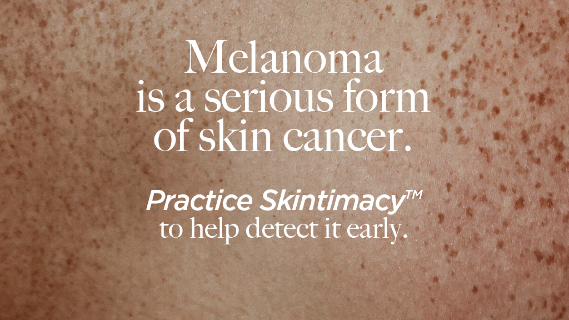 Campaign visuals with text on a skin photography that reads: Melanoma is a serious form of skin cancer. Practice Skintimacy to help detect it early.